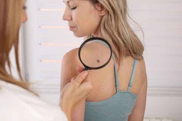 What Are Traditional Skin Lesion Removal Methods Tamworth?