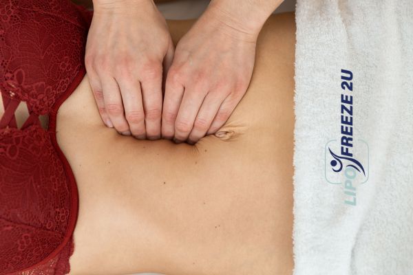 diastasis recti treatment Tamworth