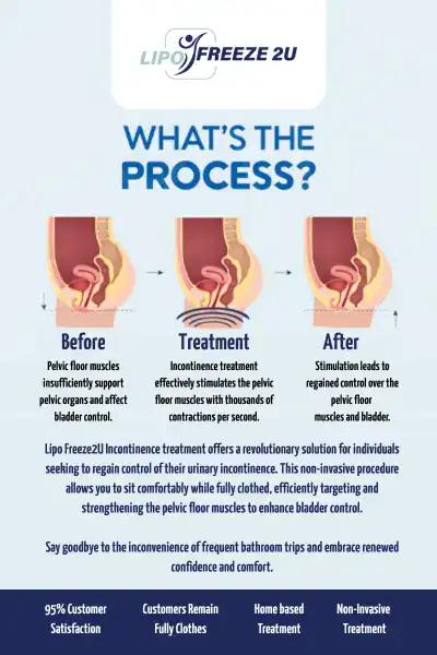 Diagram of how incontinence treatment Tamworth works.