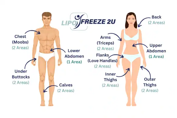 Areas you can have fat freezing treatment Tamworth