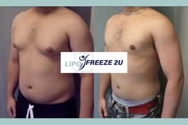How Long Does It Take to See Results Tamworth?