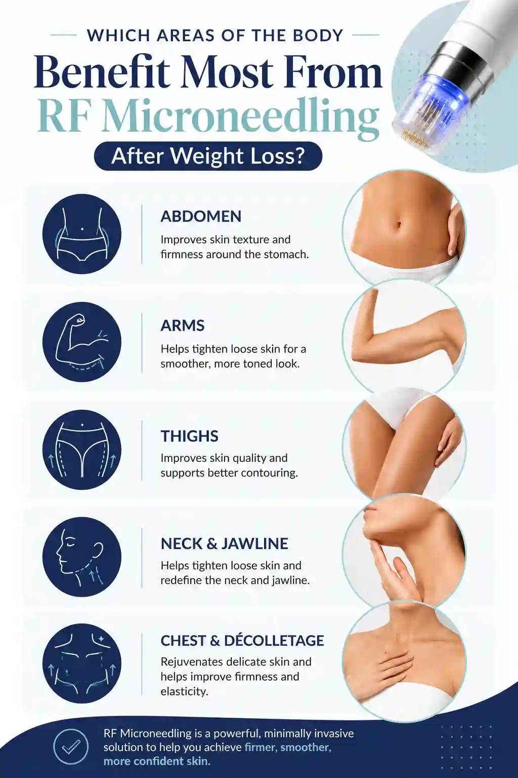 Which Areas of the Body Benefit Most From RF Microneedling After Weight Loss Tamworth